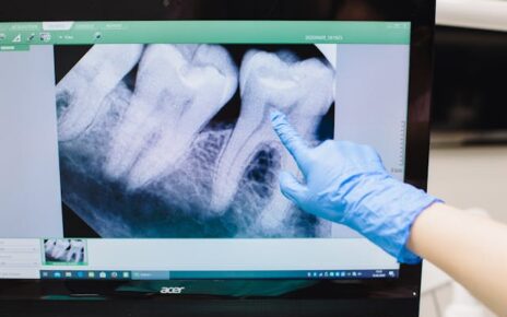 Co to jest tomografia zęba i na czym polega?