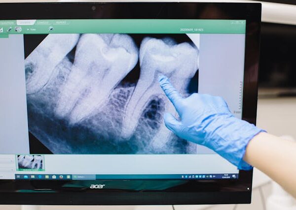 Co to jest tomografia zęba i na czym polega?