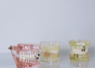 Kiedy warto zdecydować się na nowe zęby w jeden dzień?