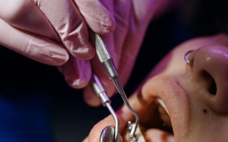 Czy Invisalign naprawdę prostuje zęby?
